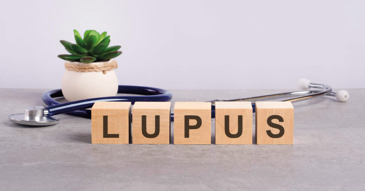 lupus enfermedad